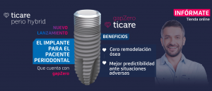 Banner ventajas Ticare Perio Hybrid