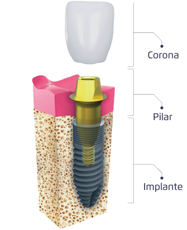 Imagen Columna 1